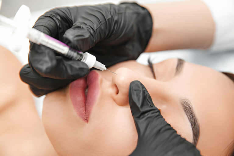 nose filler in london